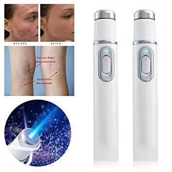 Blue Light Therapy Acne Pen