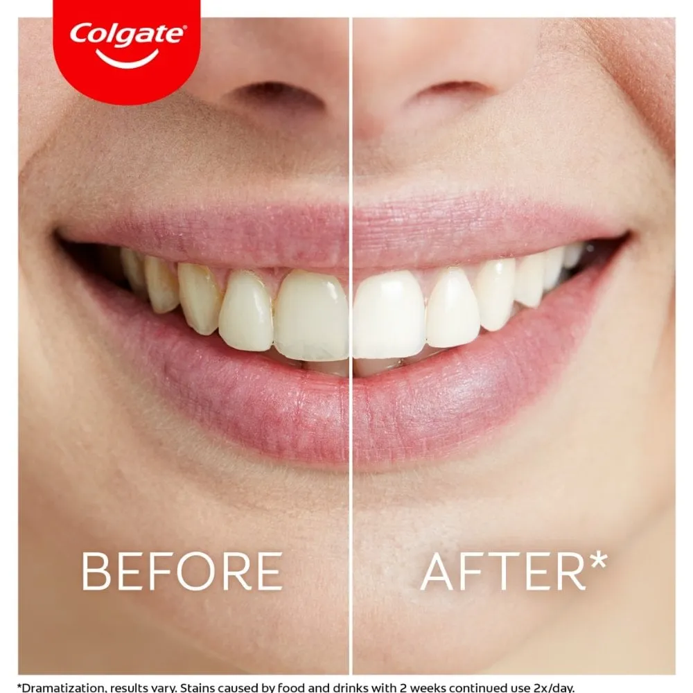 Colgate Max White Ultimate LED Whitening Kit