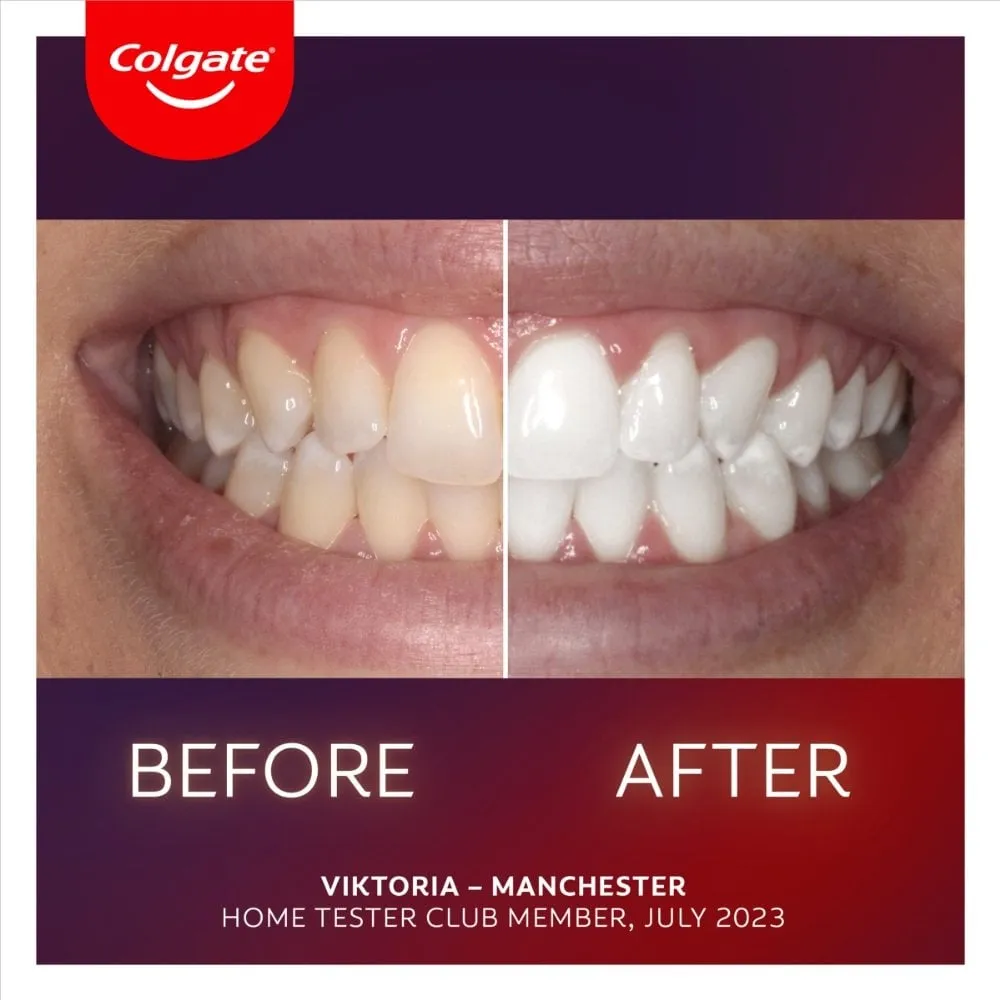 Colgate Max White Ultimate LED Whitening Kit