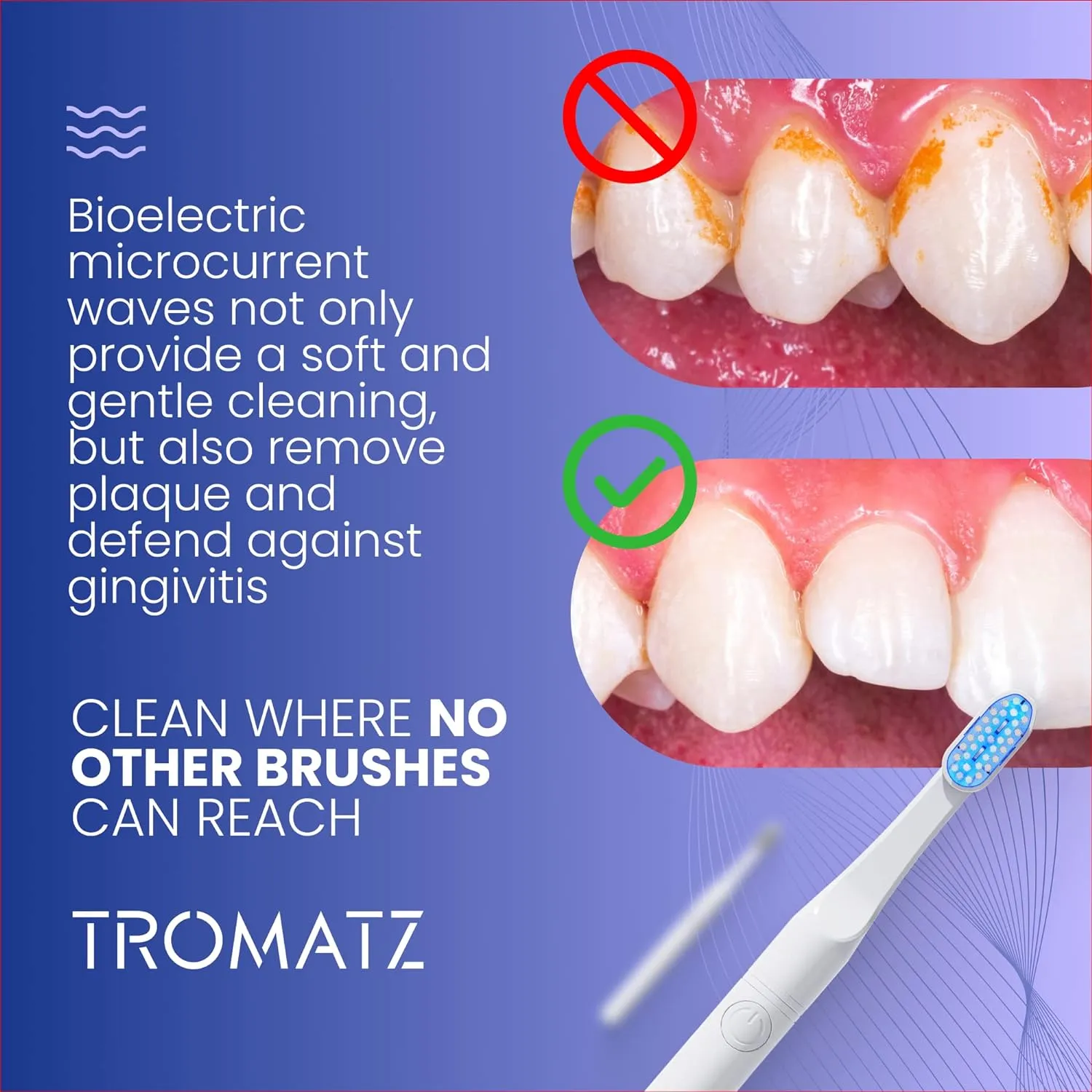 TROMATZ Toothbrush - Simple Pro Rechargeable